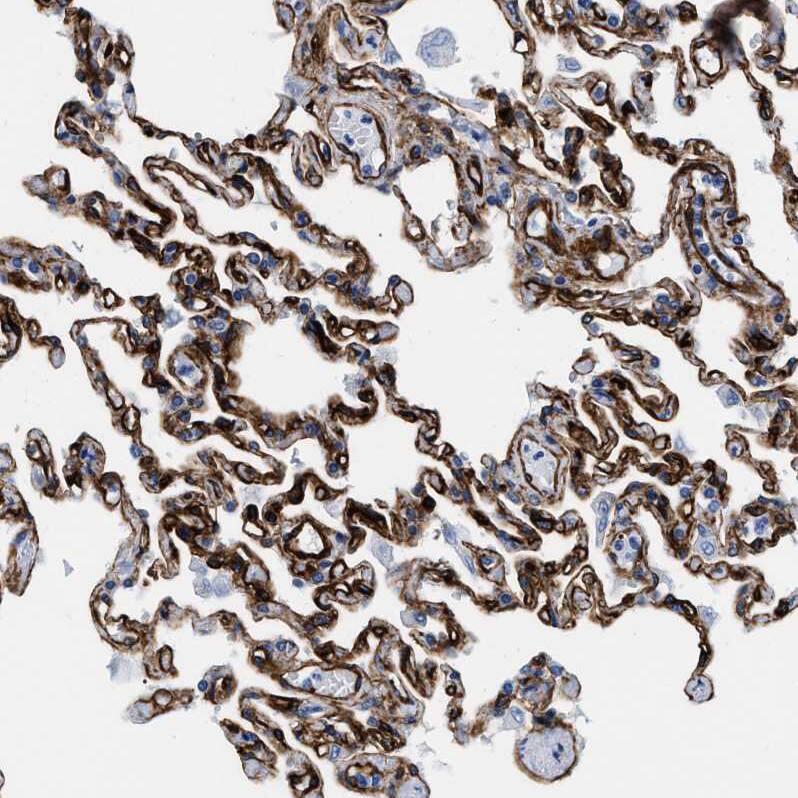 FAM18B Antibody - BSA Free Immunohistochemistry-Paraffin: FAM18B Antibody - BSA Free [NBP1-88090]