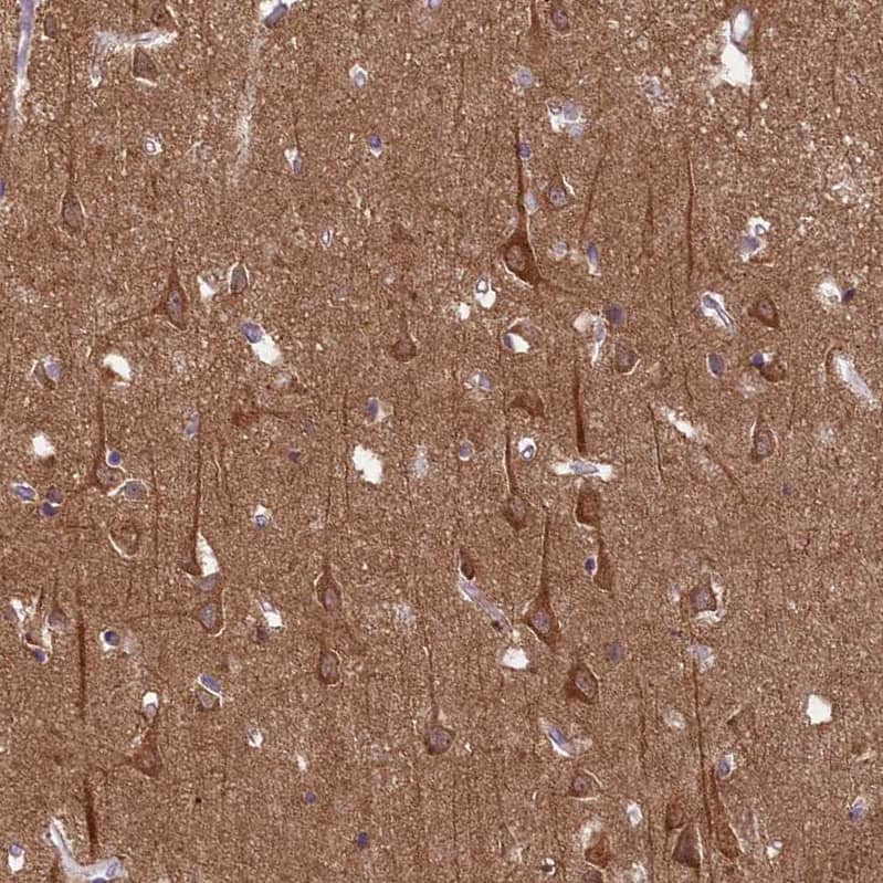CGI-128 Antibody - BSA Free Immunohistochemistry-Paraffin: CGI-128 Antibody - BSA Free [NBP1-88091]