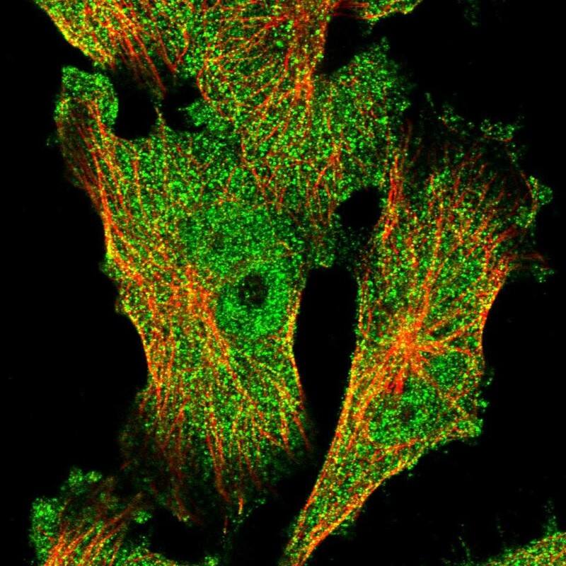 CGI-128 Antibody - BSA Free Immunocytochemistry/ Immunofluorescence: CGI-128 Antibody - BSA Free [NBP1-88091]