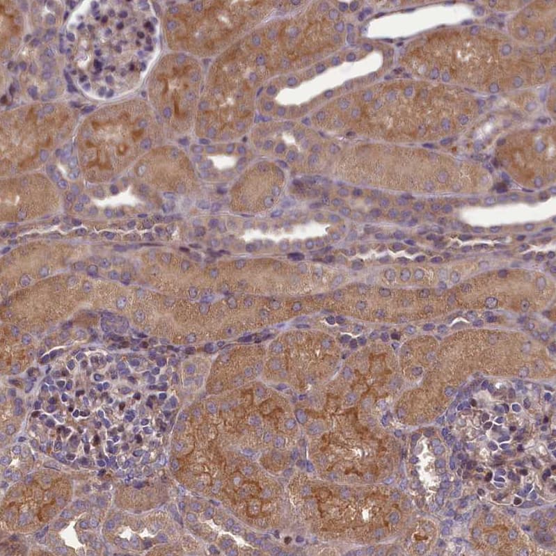CGI-128 Antibody - BSA Free Immunohistochemistry-Paraffin: CGI-128 Antibody - BSA Free [NBP1-88091]