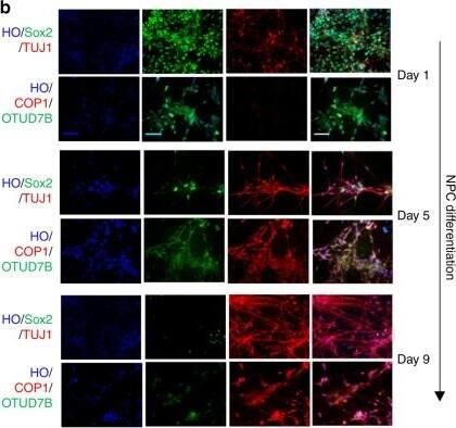 OTUD7B/Cezanne/ZA20D1 Antibody