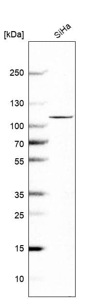 OTUD7B/Cezanne/ZA20D1 Antibody - BSA Free Western Blot: OTUD7B/Cezanne/ZA20D1 Antibody - BSA Free [NBP1-88095]