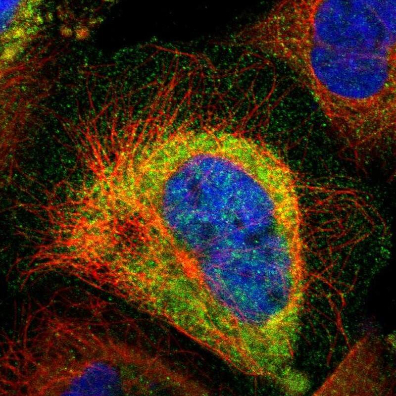 Centaurin alpha 1 Antibody - BSA Free Immunocytochemistry/ Immunofluorescence: Centaurin alpha 1 Antibody [NBP1-88097]