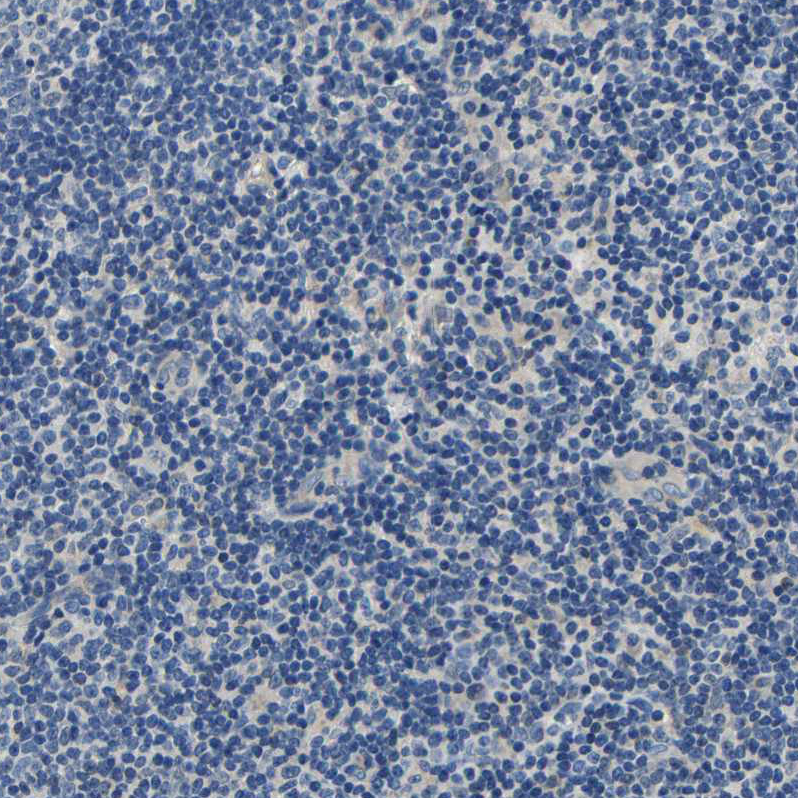 Centaurin alpha 1 Antibody - BSA Free Immunohistochemistry-Paraffin: Centaurin alpha 1 Antibody - BSA Free [NBP1-88098]