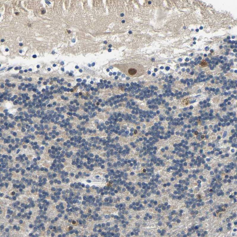 Centaurin alpha 1 Antibody - BSA Free Immunohistochemistry-Paraffin: Centaurin alpha 1 Antibody - BSA Free [NBP1-88098]