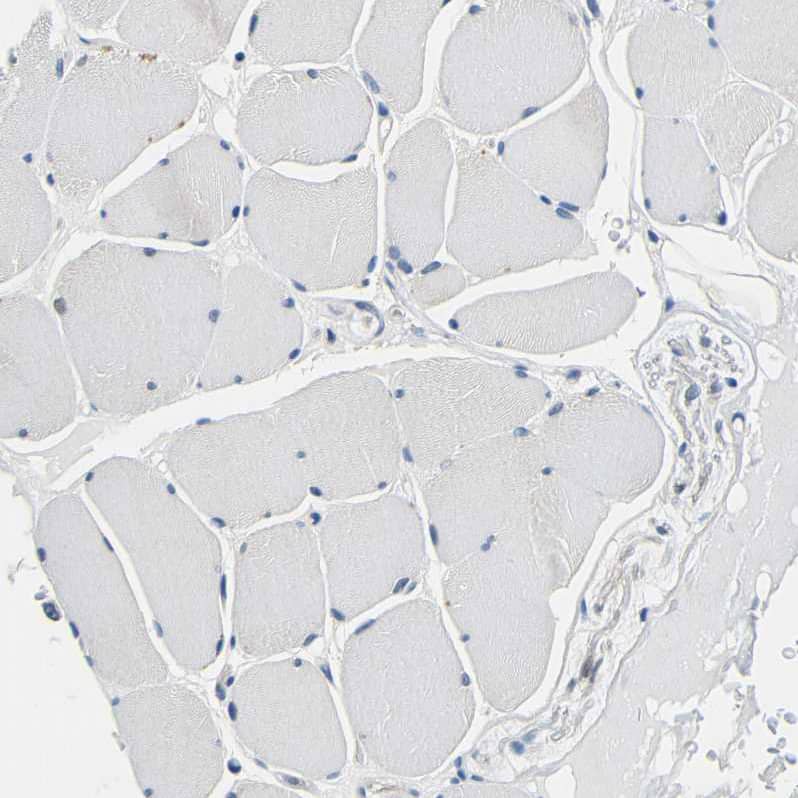 Centaurin alpha 1 Antibody - BSA Free Immunohistochemistry-Paraffin: Centaurin alpha 1 Antibody - BSA Free [NBP1-88098]