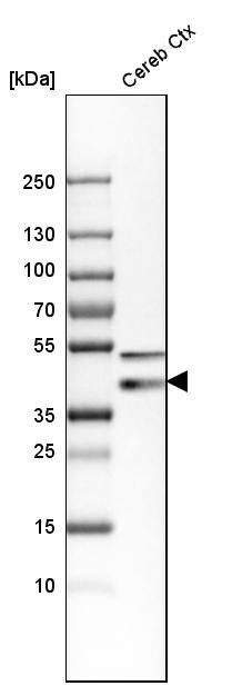 Synaptophysin Antibody - BSA Free Western Blot: Synaptophysin Antibody - BSA Free [NBP1-88112]