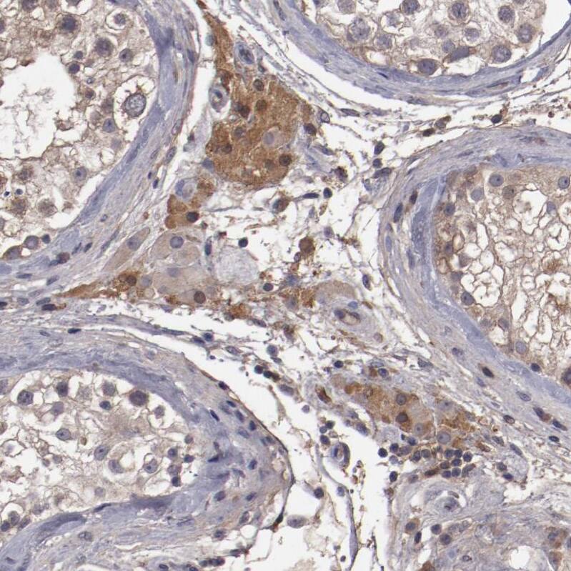 Ceruloplasmin Antibody - BSA Free Immunohistochemistry-Paraffin: Ceruloplasmin Antibody - BSA Free [NBP1-88116]