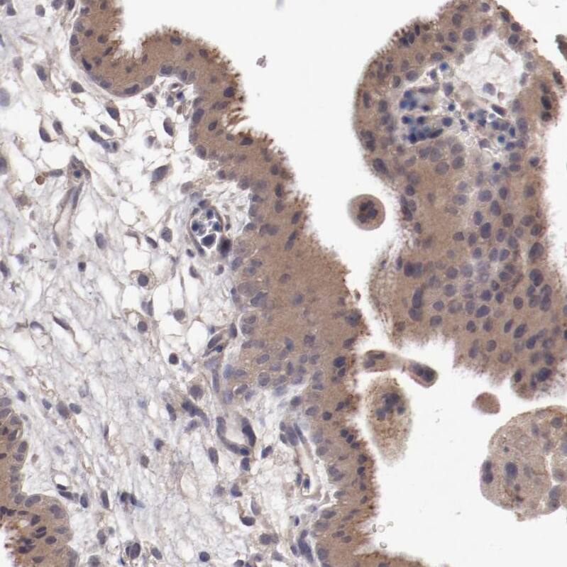 Ceruloplasmin Antibody - BSA Free Immunohistochemistry-Paraffin: Ceruloplasmin Antibody - BSA Free [NBP1-88116]