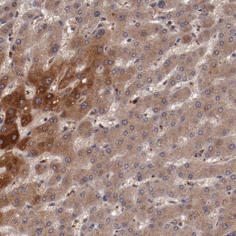 Ceruloplasmin Antibody - BSA Free Immunohistochemistry-Paraffin: Ceruloplasmin Antibody - BSA Free [NBP1-88116]