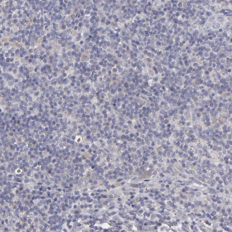 Integrin beta 5 Antibody - BSA Free Immunohistochemistry-Paraffin: Integrin beta 5 Antibody - BSA Free [NBP1-88117]