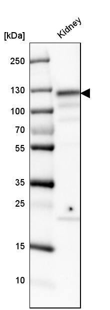 ACE-2 Antibody - BSA Free Western Blot: ACE-2 Antibody - BSA Free [NBP1-88123]