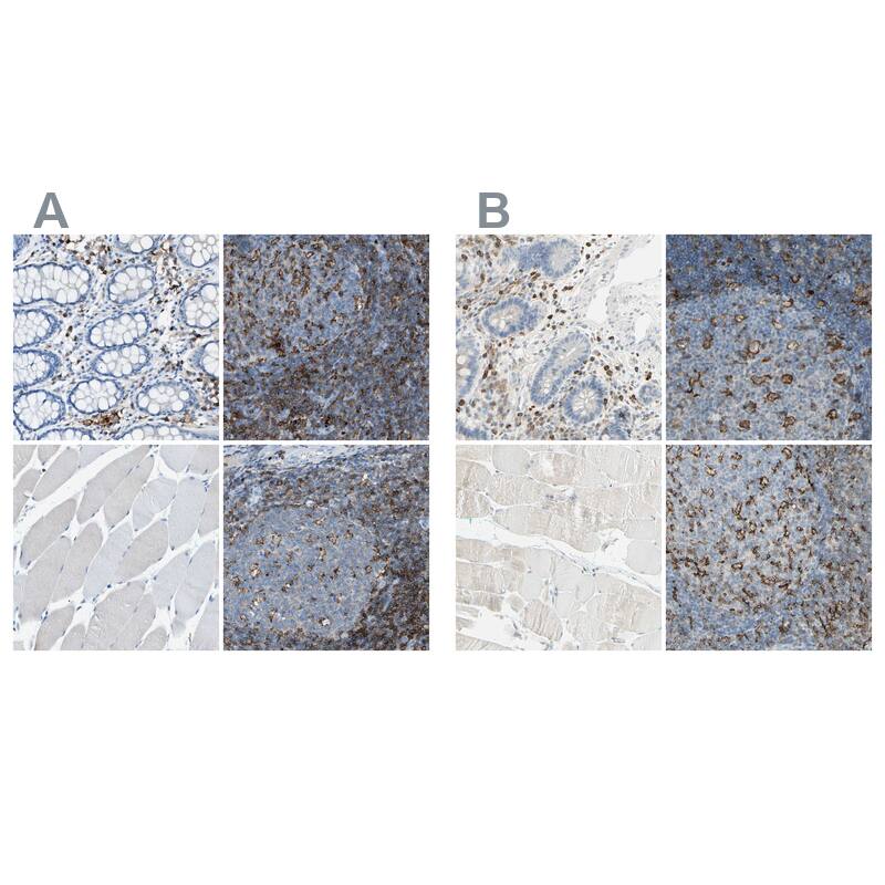 Integrin beta 2/CD18 Antibody - BSA Free Immunohistochemistry-Paraffin: Integrin beta 2/CD18 Antibody [NBP1-88127]