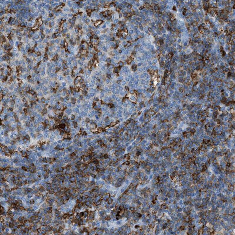 Integrin beta 2/CD18 Antibody - BSA Free Immunohistochemistry-Paraffin: Integrin beta 2/CD18 Antibody - BSA Free [NBP1-88127]