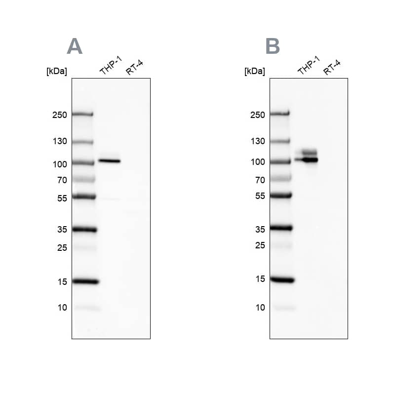 Integrin beta 2/CD18 Antibody - BSA Free Western Blot: Integrin beta 2/CD18 Antibody - BSA Free [NBP1-88127]