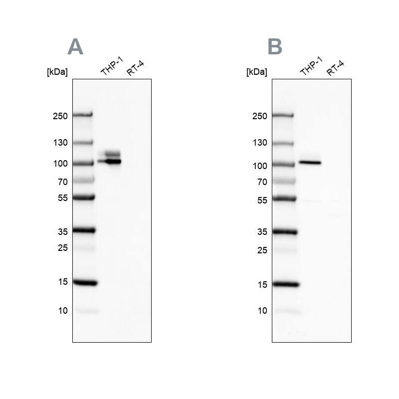 Integrin beta 2/CD18 Antibody - BSA Free Western Blot: Integrin beta 2/CD18 Antibody - BSA Free [NBP1-88128]