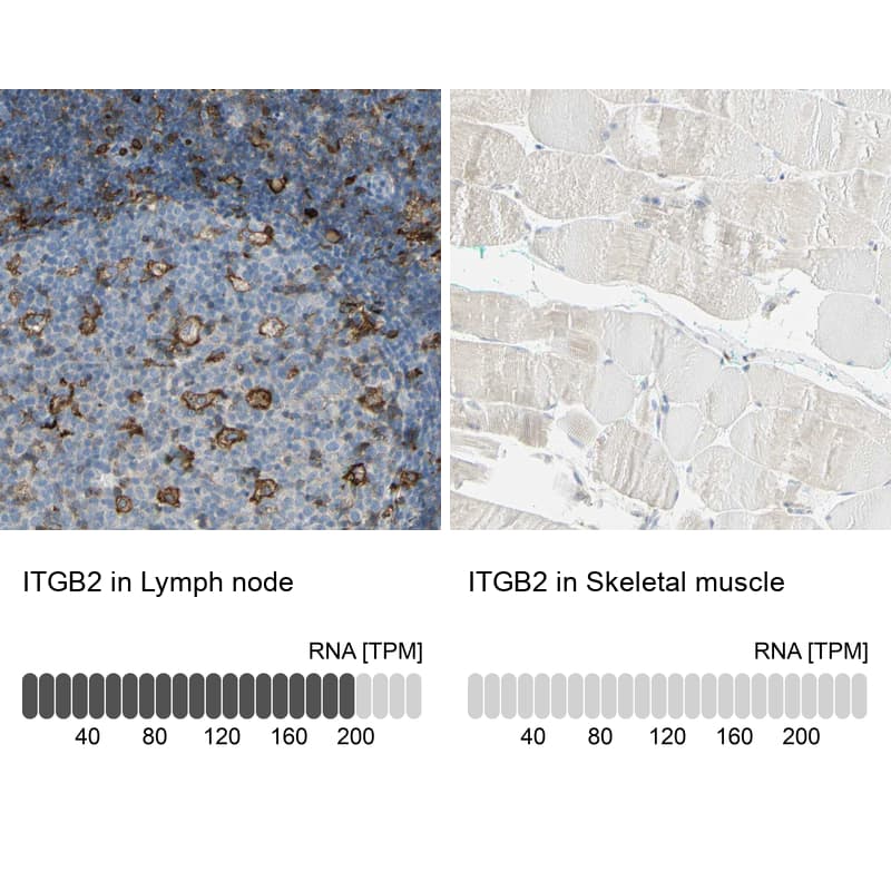 Integrin beta 2/CD18 Antibody - BSA Free Immunohistochemistry-Paraffin: Integrin beta 2/CD18 Antibody - BSA Free [NBP1-88128]