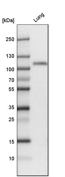 Thrombomodulin/BDCA-3 Antibody - BSA Free Western Blot: Thrombomodulin/BDCA-3 Antibody - BSA Free [NBP1-88133]