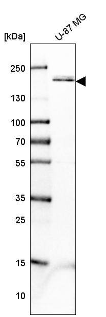 PDGF R beta Antibody - BSA Free Western Blot: PDGF R beta Antibody - BSA Free [NBP1-88134]