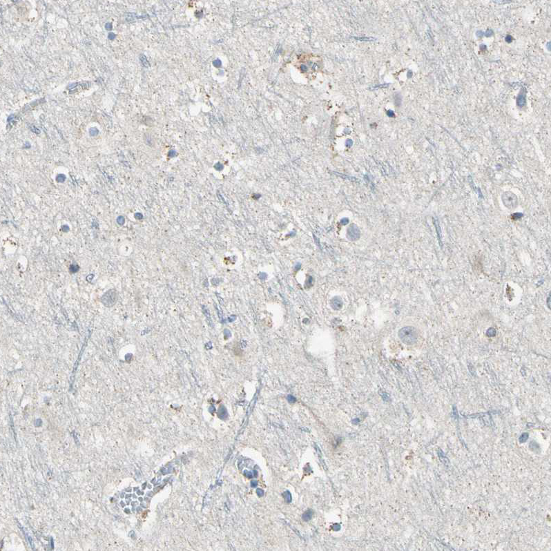 MSPR/Ron Antibody - BSA Free Immunohistochemistry-Paraffin: MSPR/Ron Antibody - BSA Free [NBP1-88136]