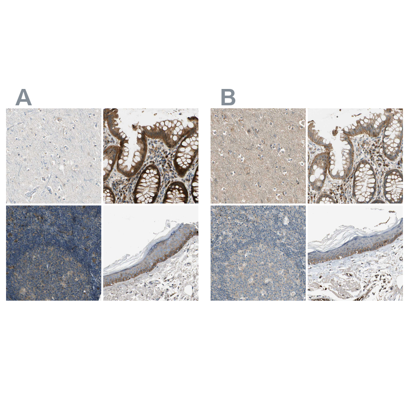 MSPR/Ron Antibody - BSA Free Immunohistochemistry-Paraffin: MSPR/Ron Antibody - BSA Free [NBP1-88136]