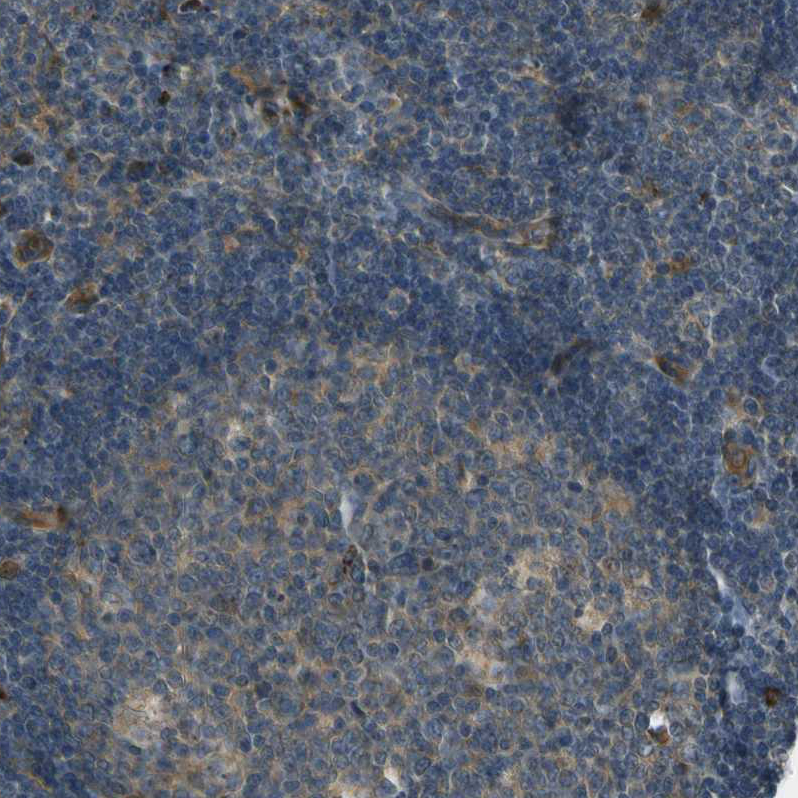 MSPR/Ron Antibody - BSA Free Immunohistochemistry-Paraffin: MSPR/Ron Antibody - BSA Free [NBP1-88136]