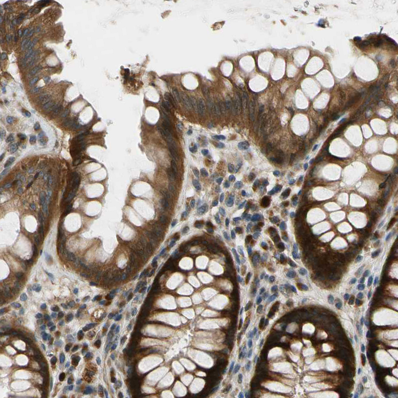 MSPR/Ron Antibody - BSA Free Immunohistochemistry-Paraffin: MSPR/Ron Antibody - BSA Free [NBP1-88136]