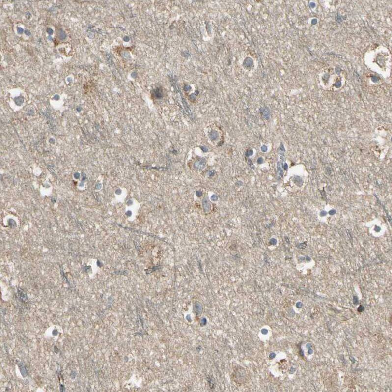 MSPR/Ron Antibody - BSA Free Immunohistochemistry-Paraffin: MSPR/Ron Antibody - BSA Free [NBP1-88137]