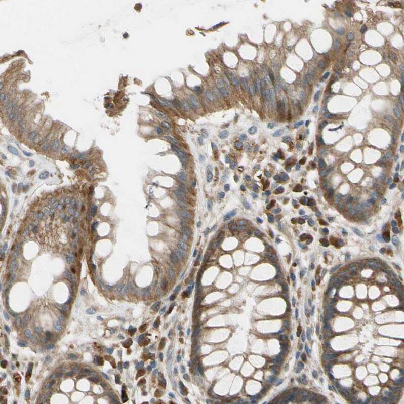 MSPR/Ron Antibody - BSA Free Immunohistochemistry-Paraffin: MSPR/Ron Antibody - BSA Free [NBP1-88137]