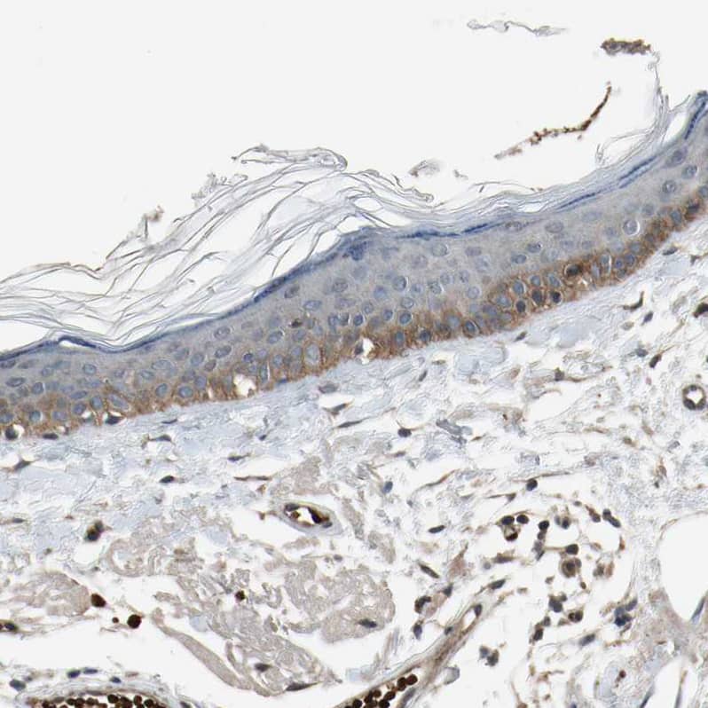 MSPR/Ron Antibody - BSA Free Immunohistochemistry-Paraffin: MSPR/Ron Antibody - BSA Free [NBP1-88137]