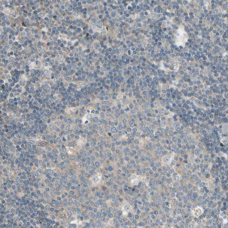 MSPR/Ron Antibody - BSA Free Immunohistochemistry-Paraffin: MSPR/Ron Antibody - BSA Free [NBP1-88137]