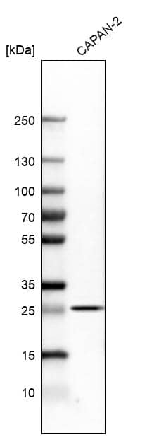 TNF RI/TNFRSF1A Antibody - BSA Free Western Blot: TNF RI/TNFRSF1A Antibody - BSA Free [NBP1-88140]