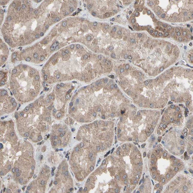 TNF RI/TNFRSF1A Antibody - BSA Free Immunohistochemistry-Paraffin: TNF RI/TNFRSF1A Antibody - BSA Free [NBP1-88140]