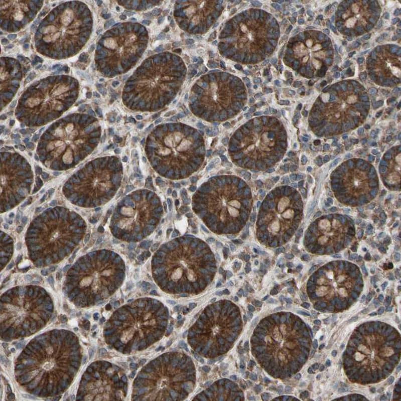 TNF RI/TNFRSF1A Antibody - BSA Free Immunohistochemistry-Paraffin: TNF RI/TNFRSF1A Antibody - BSA Free [NBP1-88140]