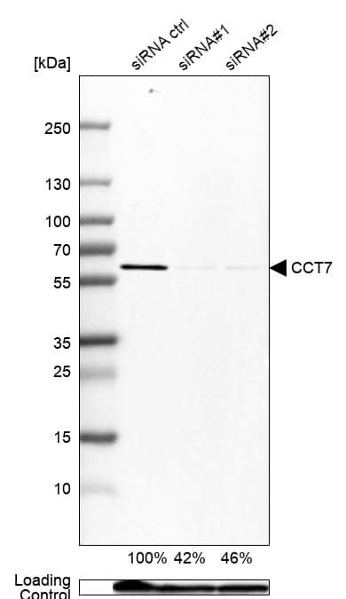 TCP1-eta Antibody - BSA Free Western Blot: TCP1-eta Antibody - BSA Free [NBP1-88144]