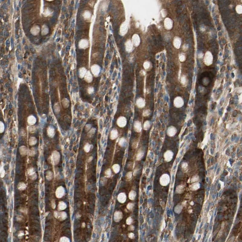 TCP1-eta Antibody - BSA Free Immunohistochemistry-Paraffin: TCP1-eta Antibody - BSA Free [NBP1-88144]