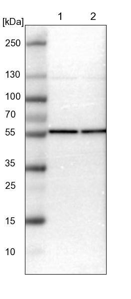 TCP1-beta Antibody - BSA Free Western Blot: TCP1-beta Antibody - BSA Free [NBP1-88146]