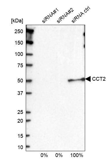 TCP1-beta Antibody - BSA Free Western Blot: TCP1-beta Antibody - BSA Free [NBP1-88146]