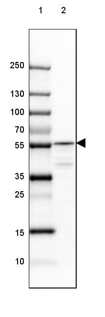 TCP1-beta Antibody - BSA Free Western Blot: TCP1-beta Antibody - BSA Free [NBP1-88146]