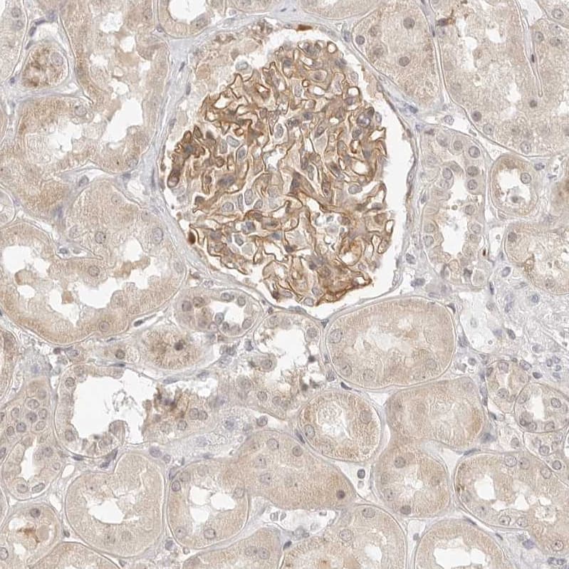 TCP1 alpha Antibody - BSA Free Immunohistochemistry-Paraffin: TCP1 alpha Antibody - BSA Free [NBP1-88148]