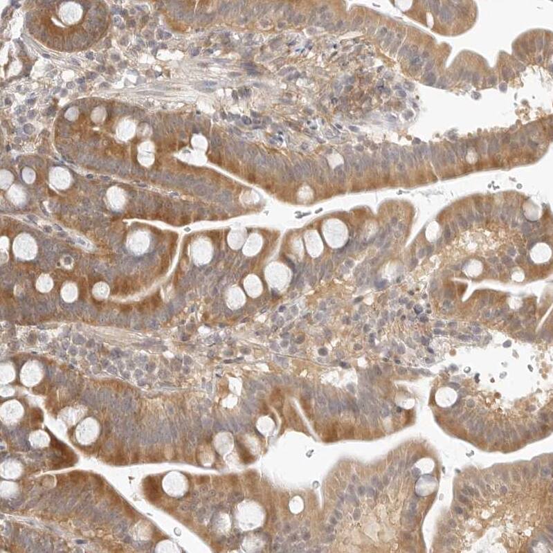 TCP1 alpha Antibody - BSA Free Immunohistochemistry-Paraffin: TCP1 alpha Antibody - BSA Free [NBP1-88148]