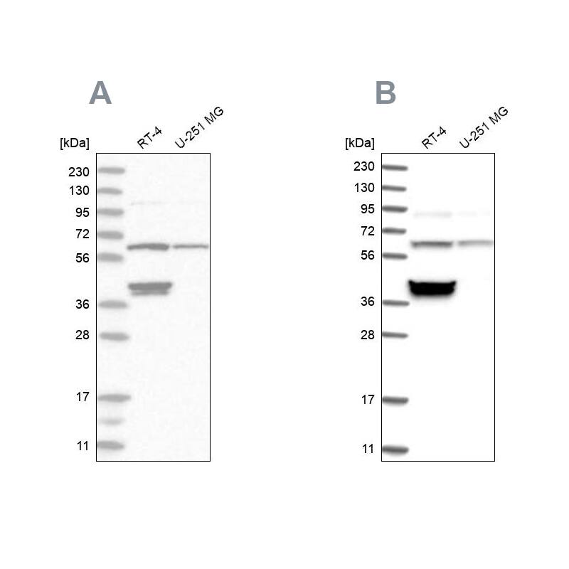 TCP1 alpha Antibody - BSA Free Western Blot: TCP1 alpha Antibody - BSA Free [NBP1-88148]