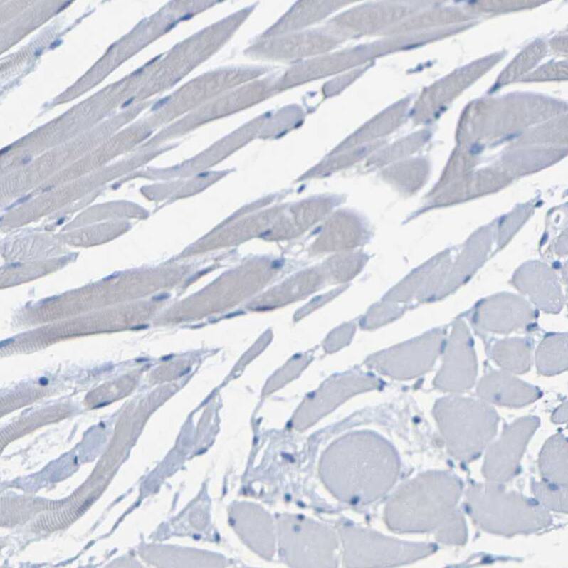 CC Chemokine Receptor D6 Antibody - BSA Free Immunohistochemistry-Paraffin: CC Chemokine Receptor D6 Antibody - BSA Free [NBP1-88150]