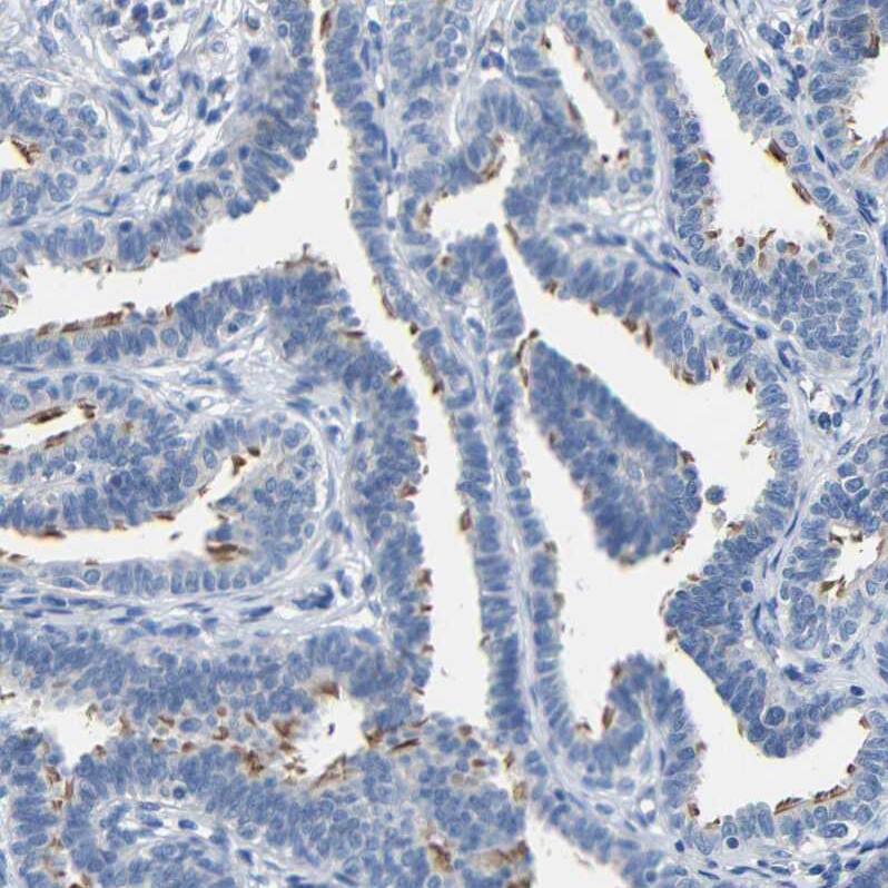 CC Chemokine Receptor D6 Antibody - BSA Free Immunohistochemistry-Paraffin: CC Chemokine Receptor D6 Antibody - BSA Free [NBP1-88150]