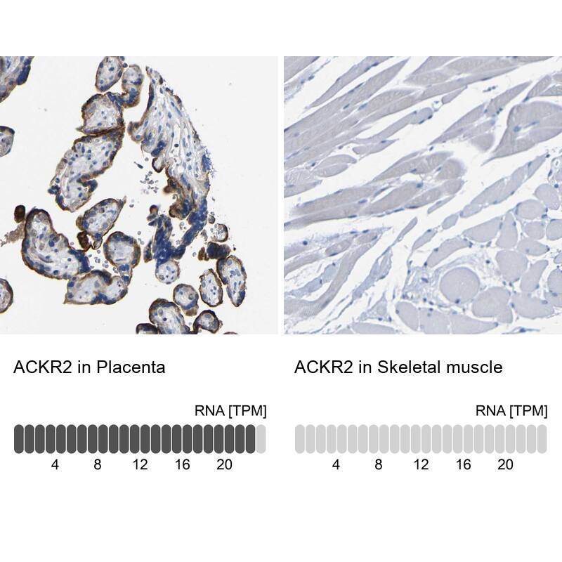 CC Chemokine Receptor D6 Antibody - BSA Free Immunohistochemistry-Paraffin: CC Chemokine Receptor D6 Antibody - BSA Free [NBP1-88150]