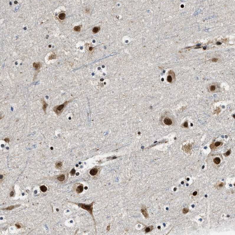 Cyclin E1 Antibody - BSA Free Immunohistochemistry-Paraffin: Cyclin E1 Antibody - BSA Free [NBP1-88153]