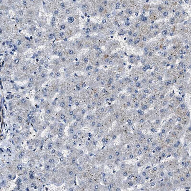 Cyclin E1 Antibody - BSA Free Immunohistochemistry-Paraffin: Cyclin E1 Antibody - BSA Free [NBP1-88153]