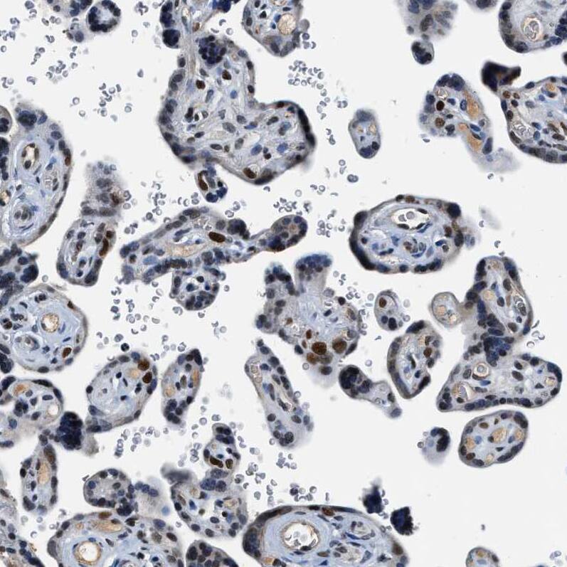 Cyclin E1 Antibody - BSA Free Immunohistochemistry-Paraffin: Cyclin E1 Antibody - BSA Free [NBP1-88153]