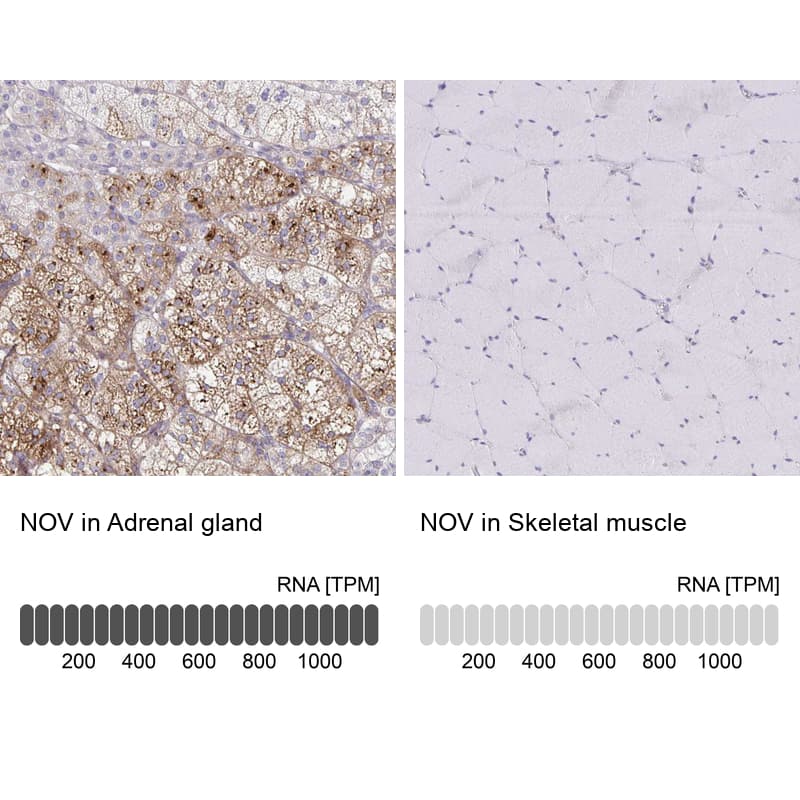 NOV/CCN3 Antibody - BSA Free Immunohistochemistry-Paraffin: NOV/CCN3 Antibody - BSA Free [NBP1-88154]