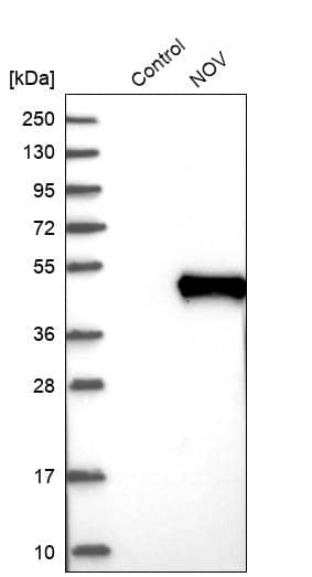 NOV/CCN3 Antibody - BSA Free Western Blot: NOV/CCN3 Antibody - BSA Free [NBP1-88154]